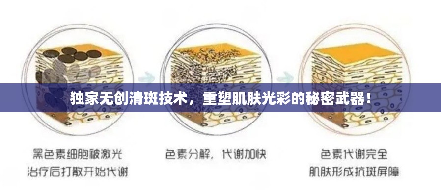 独家无创清斑技术,重塑肌肤光彩的秘密武器!